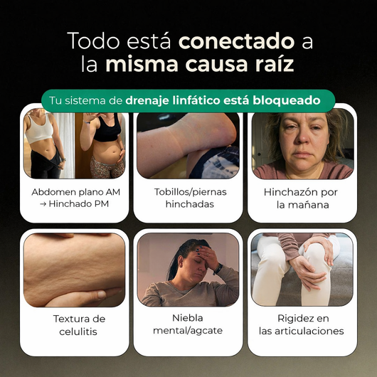 Nueva Fórmula de Máxima Potencia – Cápsulas de Drenaje Linfático eskin™ Sculpt